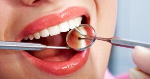 The Importance of Regular Dental Checkups for a Healthy Smile