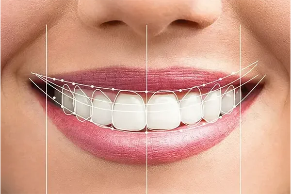 Full Mouth Rehabilitation-final